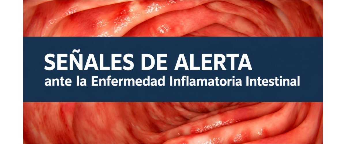 Senales-Alerta