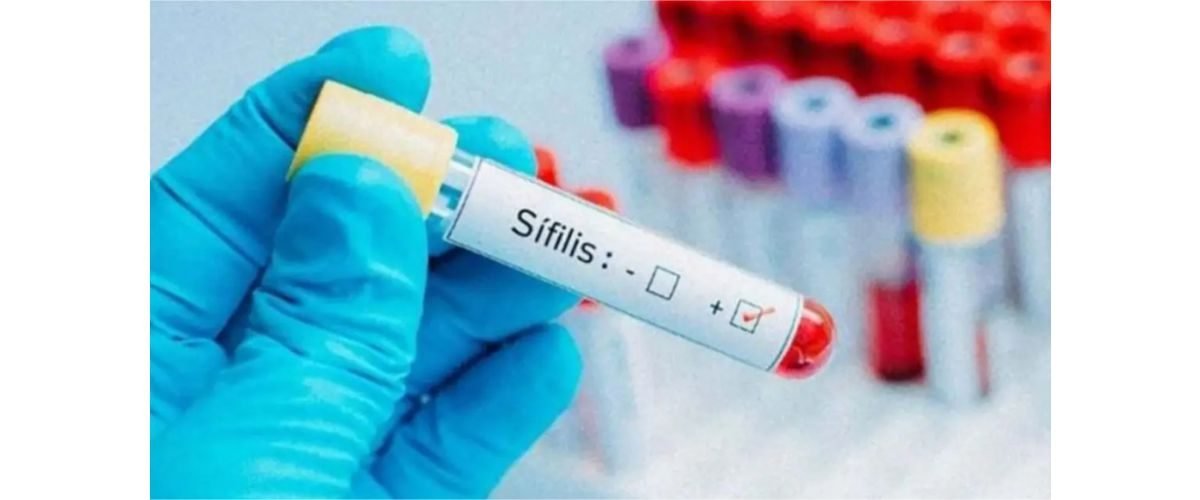 sifilis